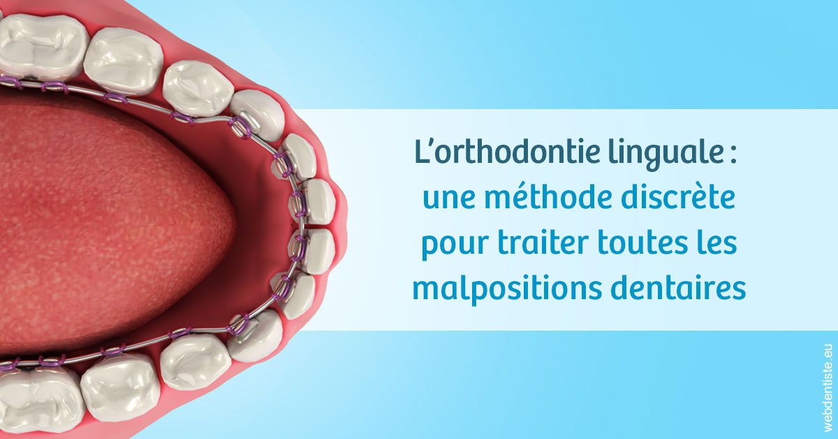 https://selarl-berdah.chirurgiens-dentistes.fr/L'orthodontie linguale 1