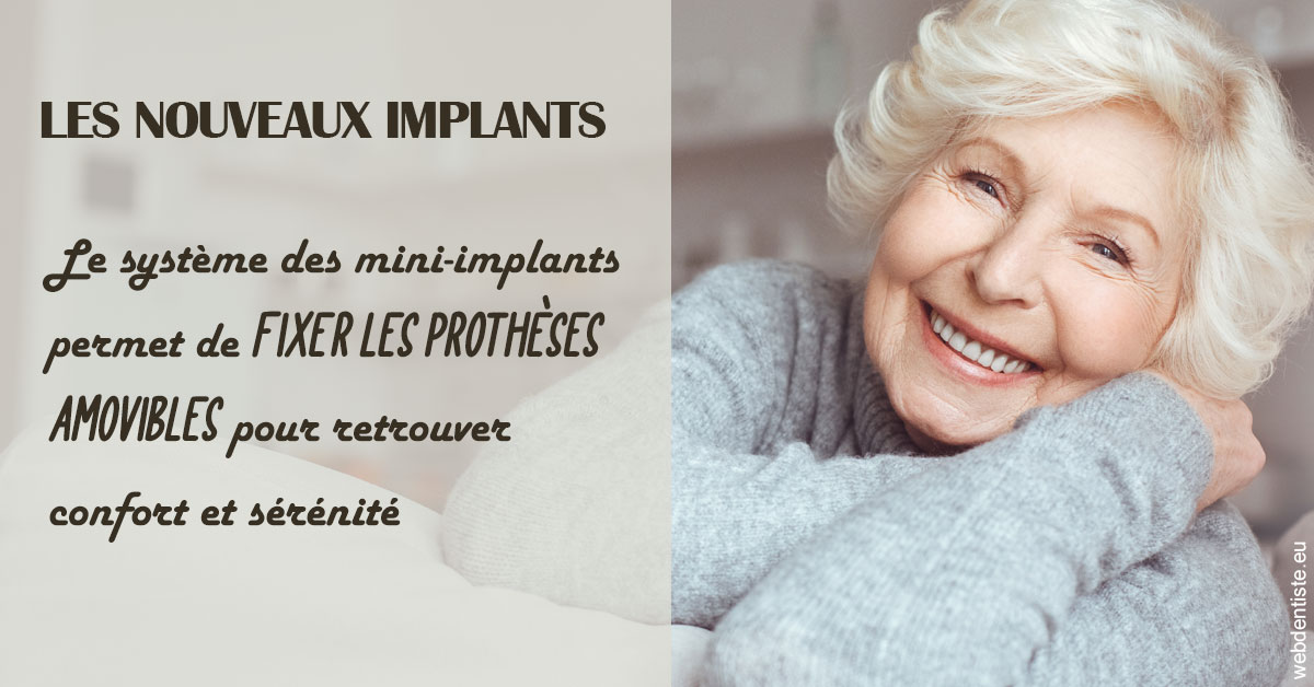 https://selarl-berdah.chirurgiens-dentistes.fr/Les nouveaux implants 1