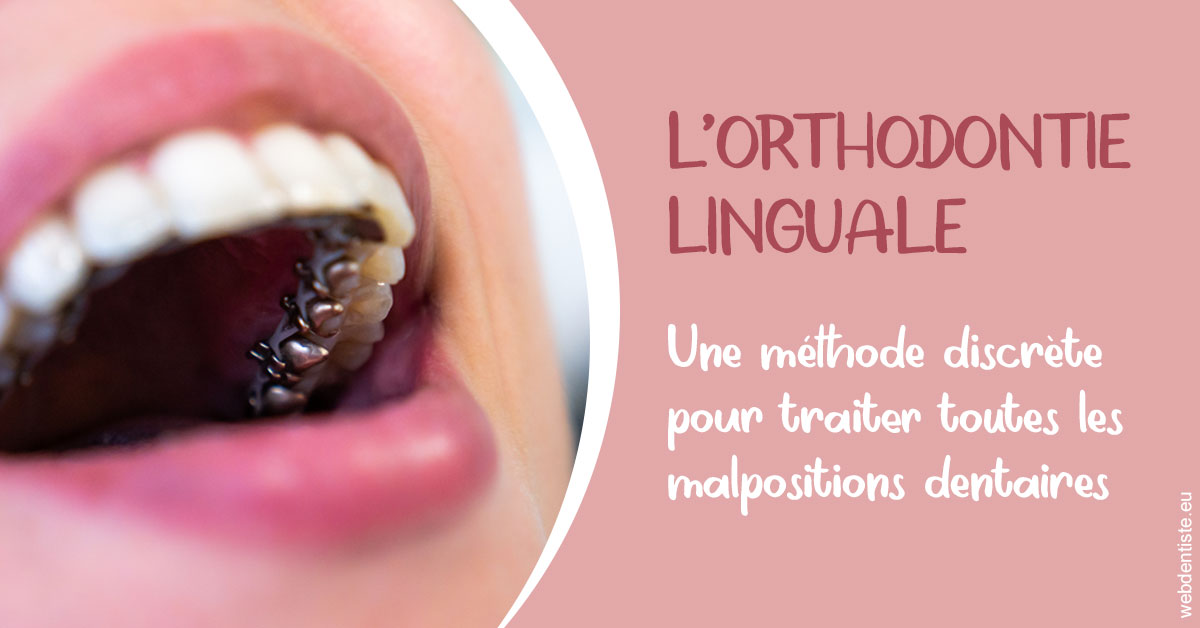 https://selarl-berdah.chirurgiens-dentistes.fr/L'orthodontie linguale 2