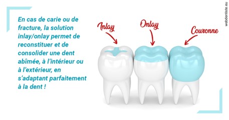 https://selarl-berdah.chirurgiens-dentistes.fr/L'INLAY ou l'ONLAY