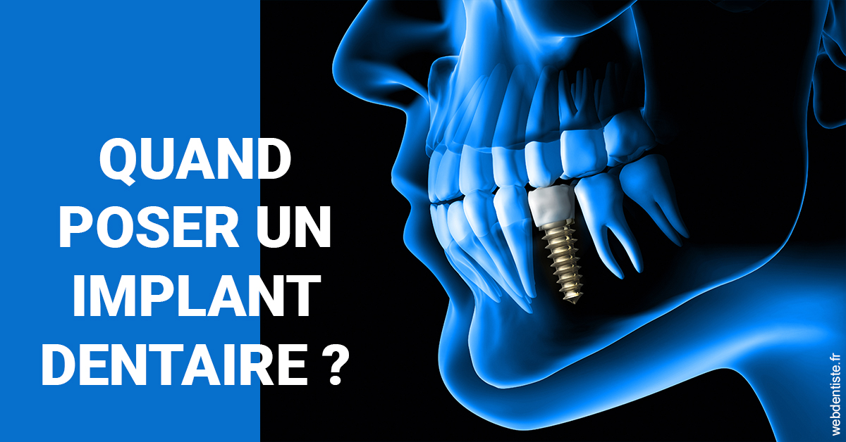 https://selarl-berdah.chirurgiens-dentistes.fr/Les implants 1