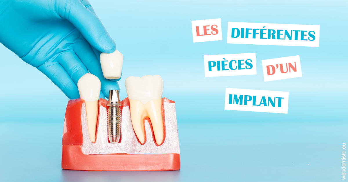 https://selarl-berdah.chirurgiens-dentistes.fr/Les différentes pièces d’un implant 2