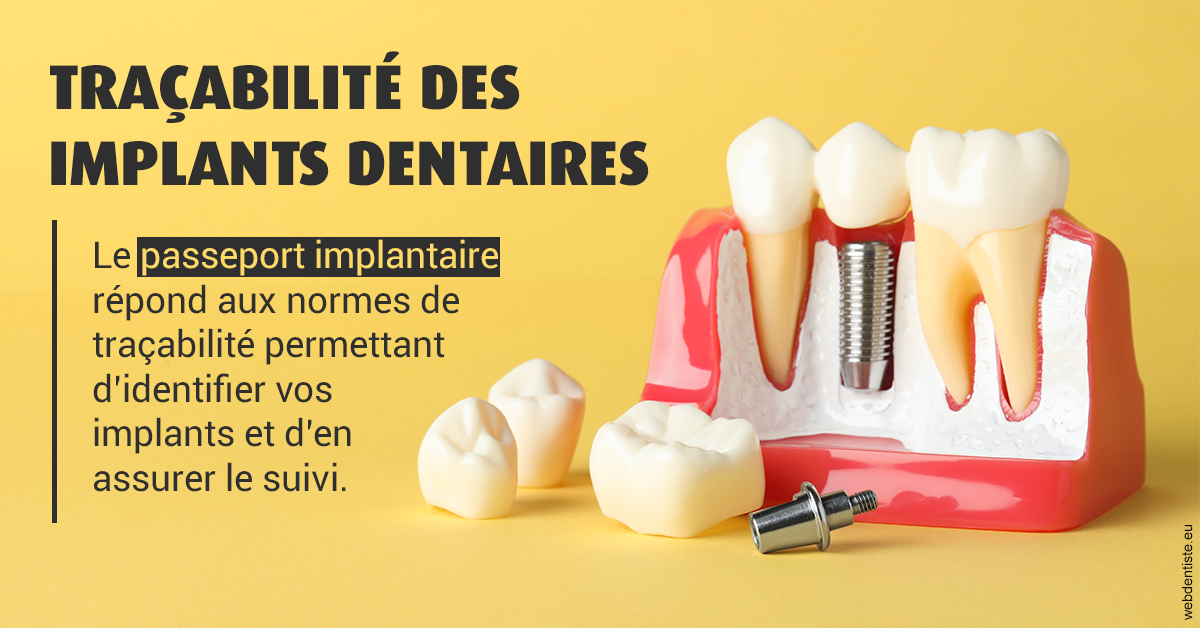 https://selarl-berdah.chirurgiens-dentistes.fr/T2 2023 - Traçabilité des implants 2