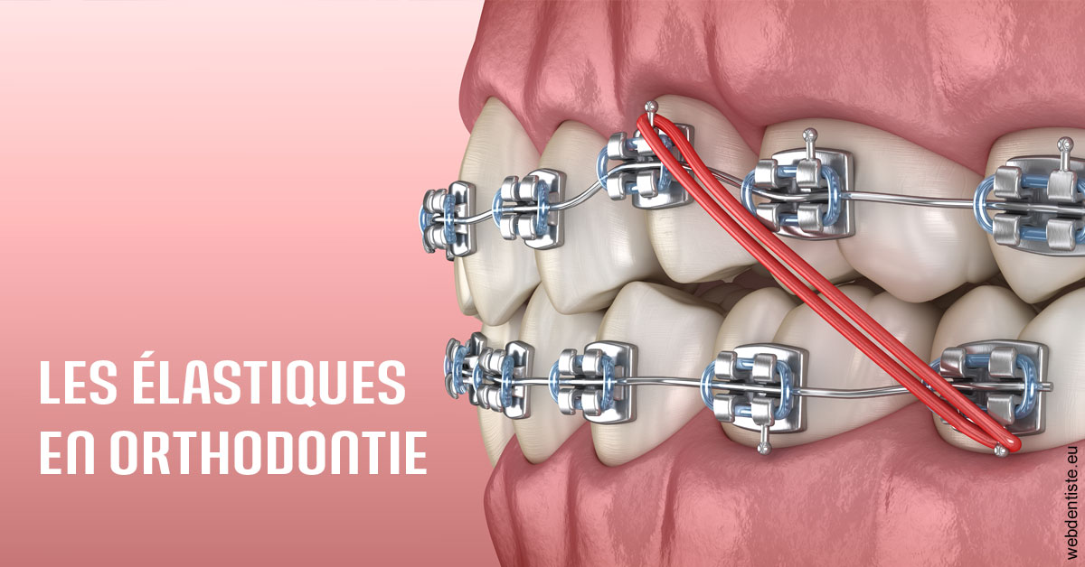 https://selarl-berdah.chirurgiens-dentistes.fr/Elastiques orthodontie 2