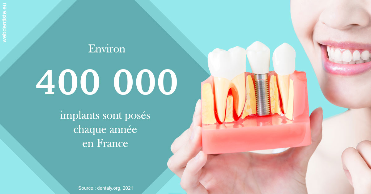 https://selarl-berdah.chirurgiens-dentistes.fr/Pose d'implants en France 2